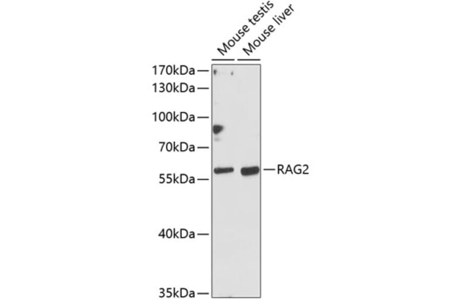 Western Blot - Anti-RAG2 Antibody (A90629) - Antibodies.com