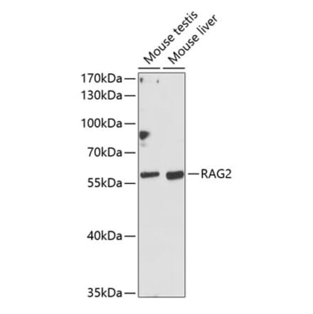 Western Blot - Anti-RAG2 Antibody (A90629) - Antibodies.com