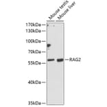 Western Blot - Anti-RAG2 Antibody (A90629) - Antibodies.com
