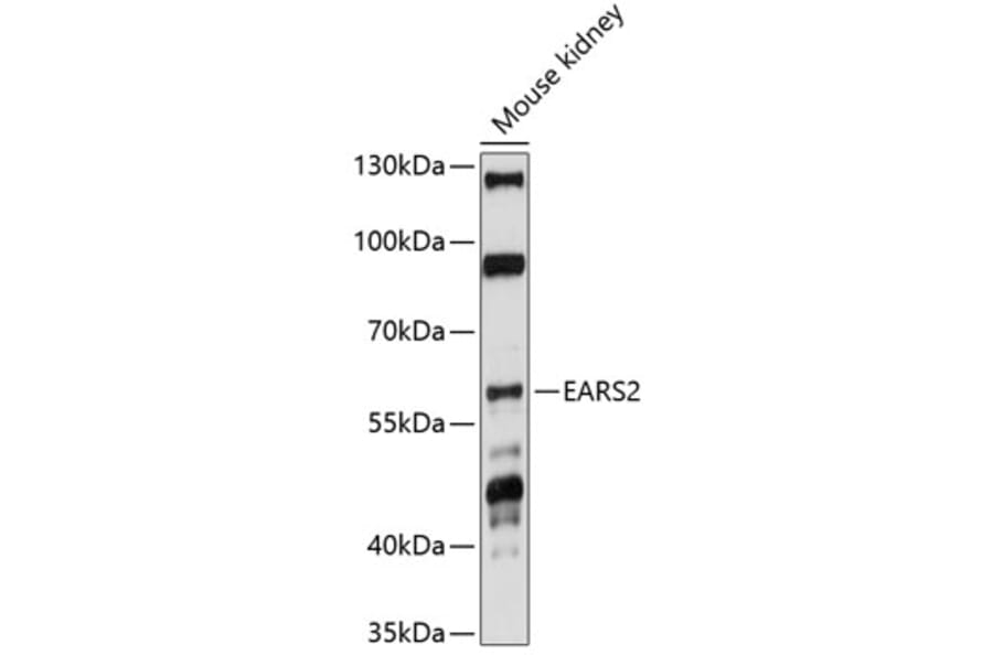 Western Blot - Anti-EARS2 Antibody (A90630) - Antibodies.com