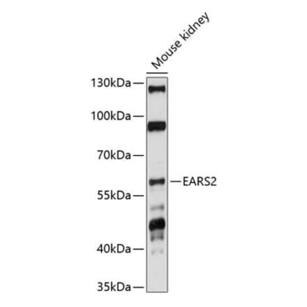 Western Blot - Anti-EARS2 Antibody (A90630) - Antibodies.com