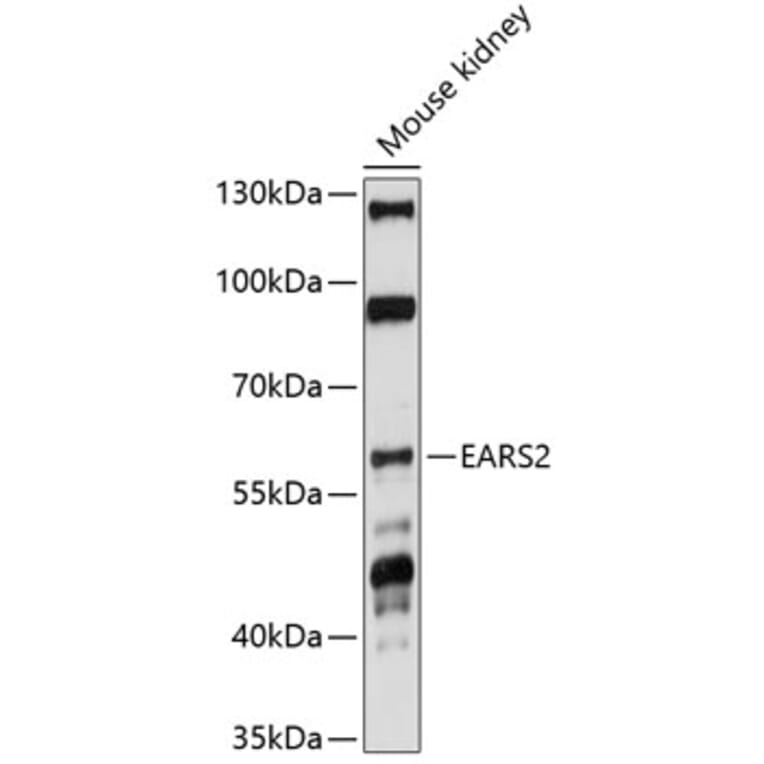 Western Blot - Anti-EARS2 Antibody (A90630) - Antibodies.com