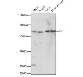 Western Blot - Anti-TRP2/DCT Antibody (A90631) - Antibodies.com