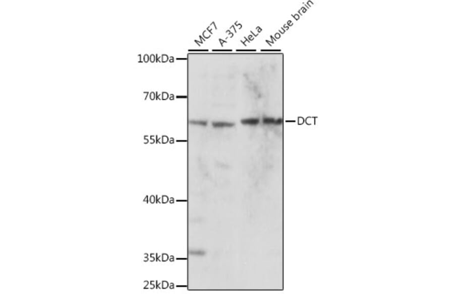 Western Blot - Anti-TRP2/DCT Antibody (A90631) - Antibodies.com