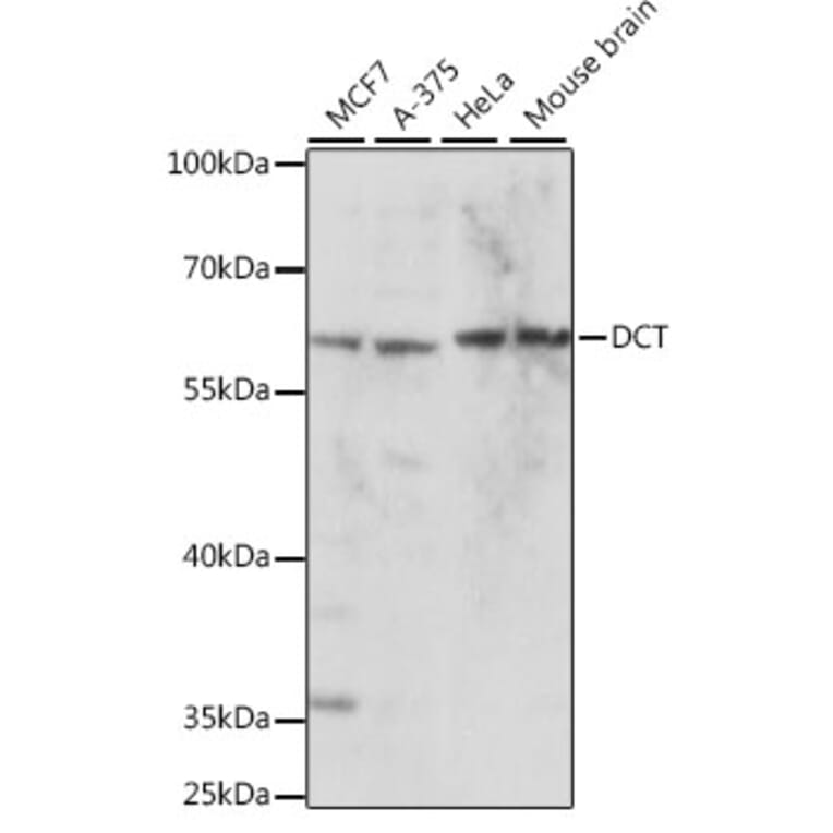 Western Blot - Anti-TRP2/DCT Antibody (A90631) - Antibodies.com