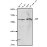 Western Blot - Anti-TRP2/DCT Antibody (A90631) - Antibodies.com