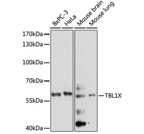 Western Blot - Anti-TBL1X Antibody (A90632) - Antibodies.com