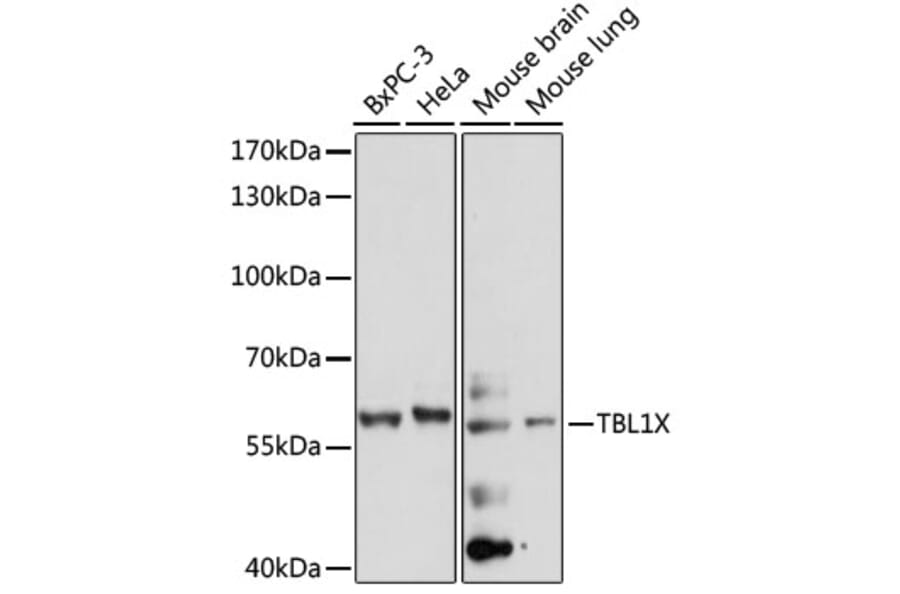Western Blot - Anti-TBL1X Antibody (A90632) - Antibodies.com