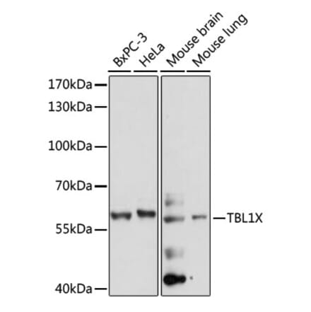 Western Blot - Anti-TBL1X Antibody (A90632) - Antibodies.com