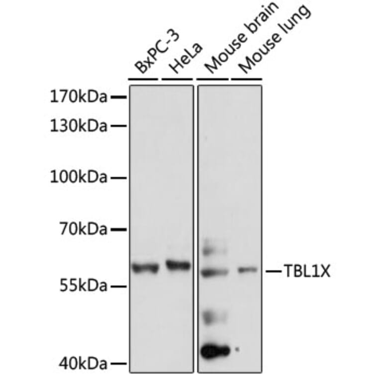 Western Blot - Anti-TBL1X Antibody (A90632) - Antibodies.com