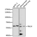 Western Blot - Anti-TBL1X Antibody (A90632) - Antibodies.com