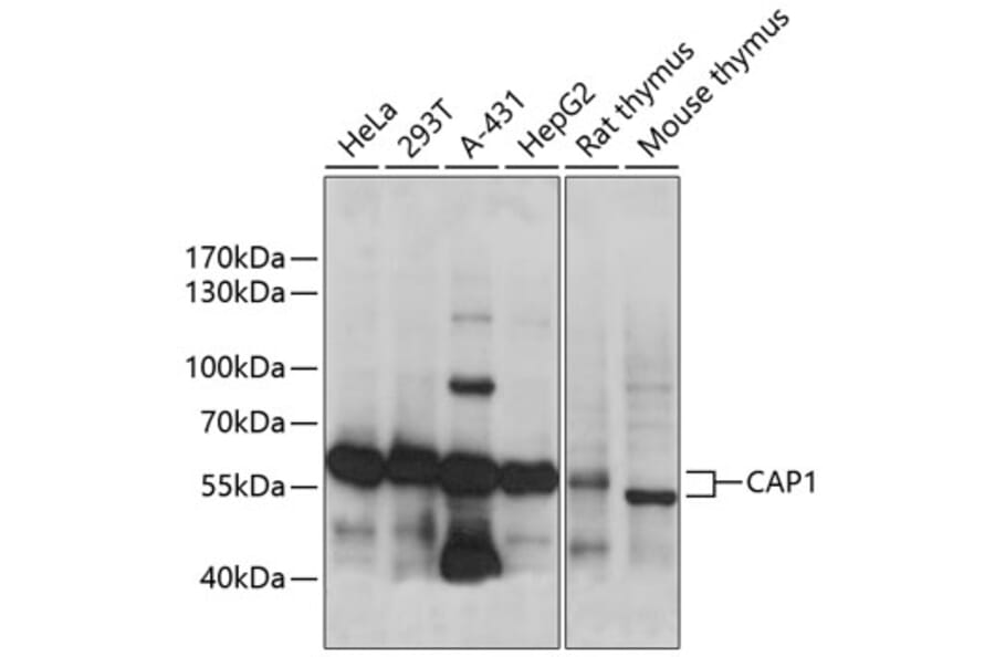 Western Blot - Anti-CAP1 Antibody (A90633) - Antibodies.com