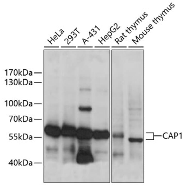 Western Blot - Anti-CAP1 Antibody (A90633) - Antibodies.com