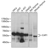 Western Blot - Anti-CAP1 Antibody (A90633) - Antibodies.com