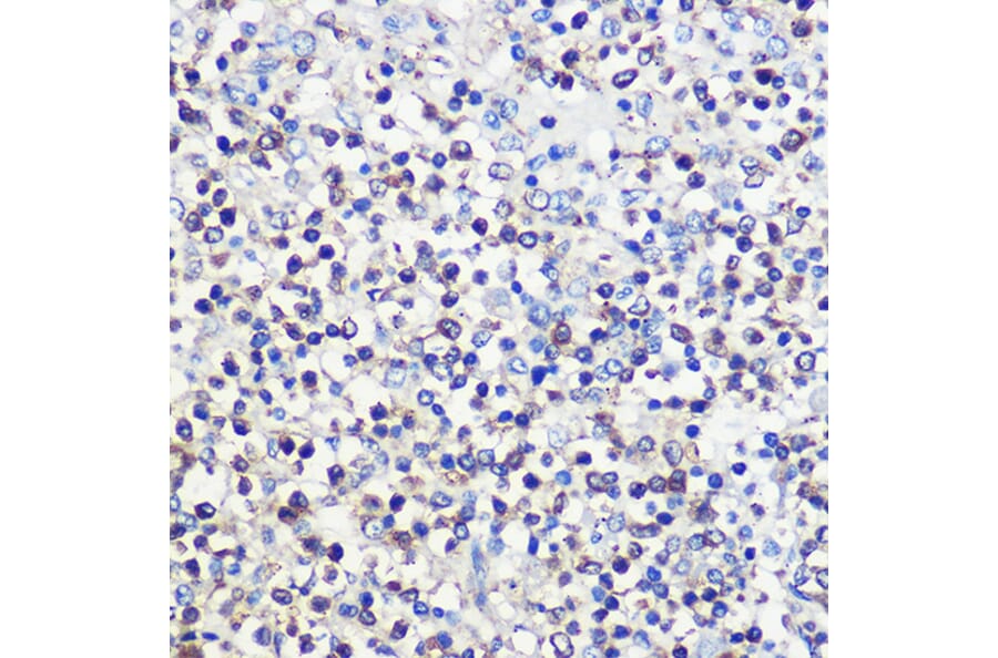 Immunohistochemistry - Anti-CD80 Antibody (A90634) - Antibodies.com