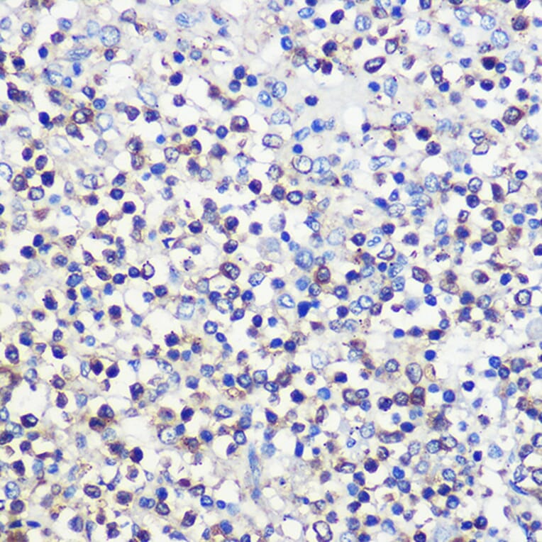 Immunohistochemistry - Anti-CD80 Antibody (A90634) - Antibodies.com