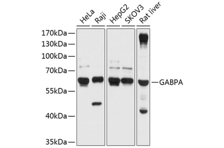 Western Blot - Anti-GABPA Antibody (A90635) - Antibodies.com