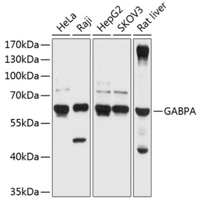 Western Blot - Anti-GABPA Antibody (A90635) - Antibodies.com