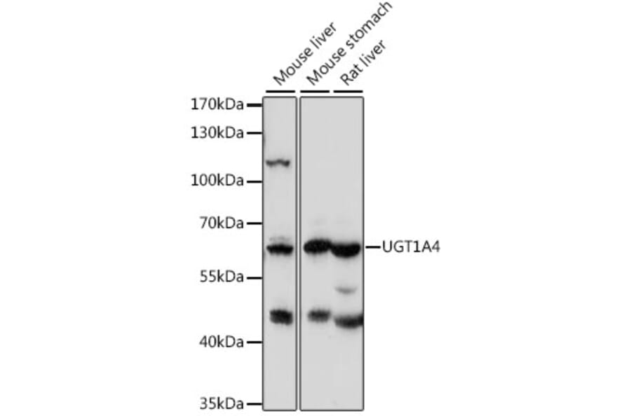 Western Blot - Anti-UGT1A4 Antibody (A15849) - Antibodies.com