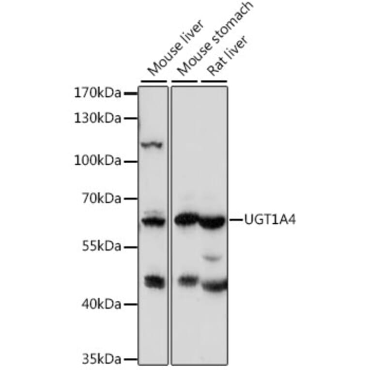 Western Blot - Anti-UGT1A4 Antibody (A15849) - Antibodies.com