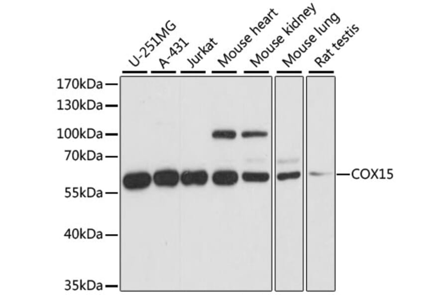 Western Blot - Anti-COX15 Antibody (A90637) - Antibodies.com