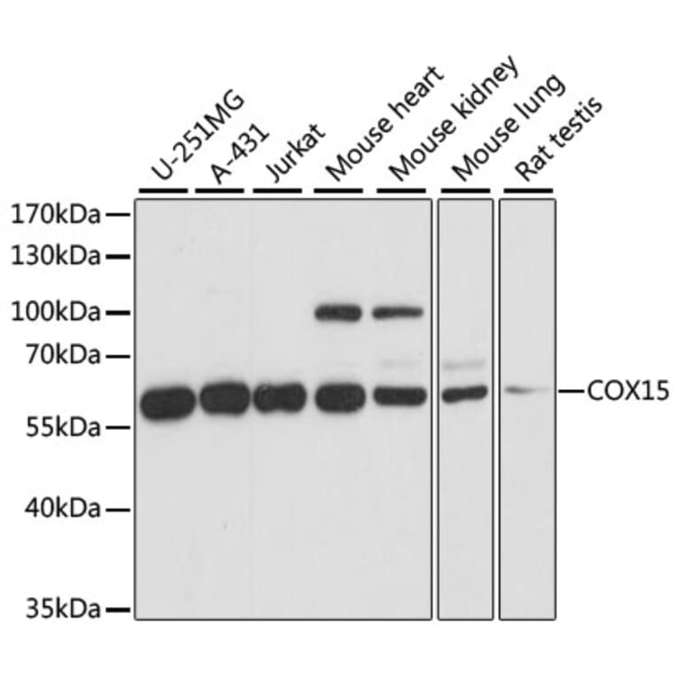 Western Blot - Anti-COX15 Antibody (A90637) - Antibodies.com