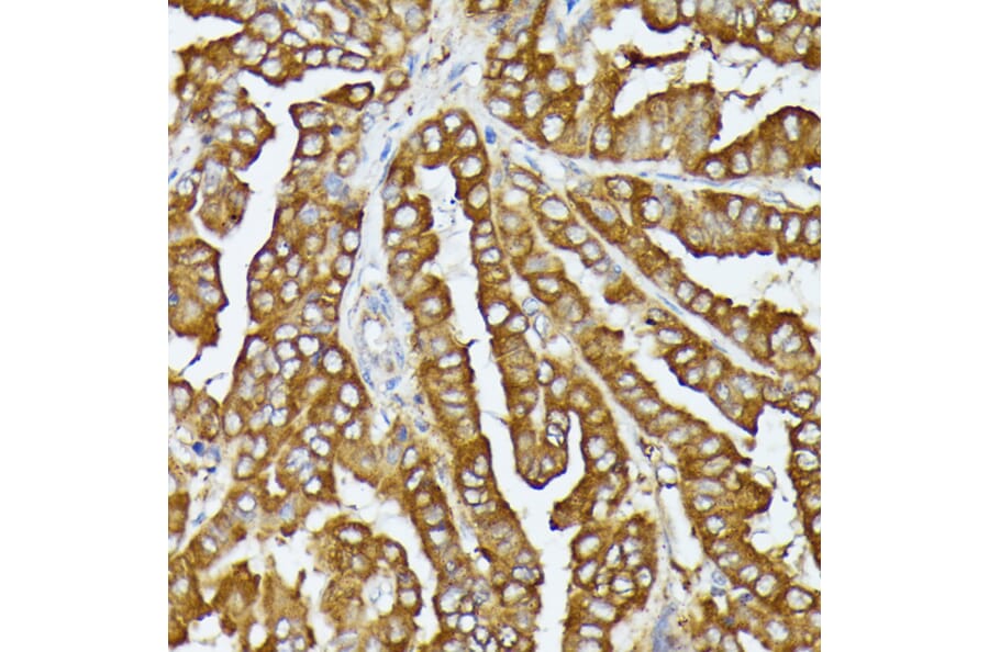 Immunohistochemistry - Anti-COX15 Antibody (A90637) - Antibodies.com