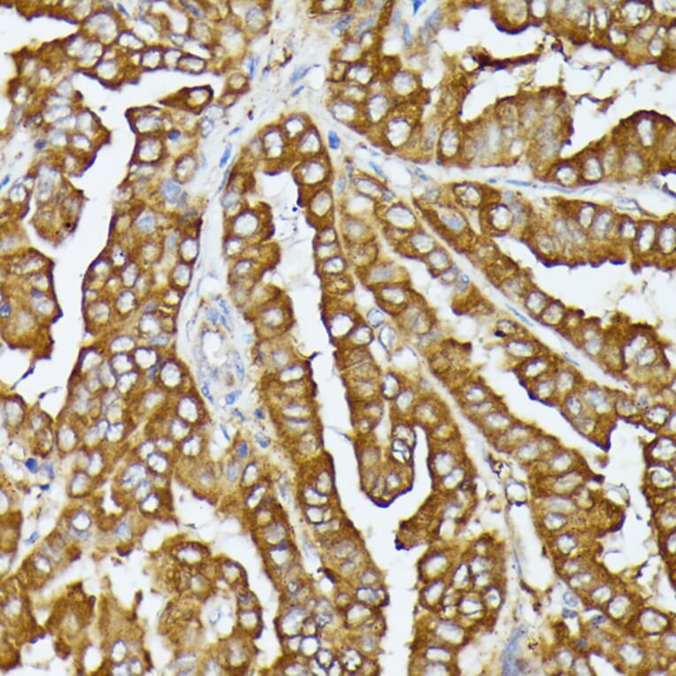 Immunohistochemistry - Anti-COX15 Antibody (A90637) - Antibodies.com