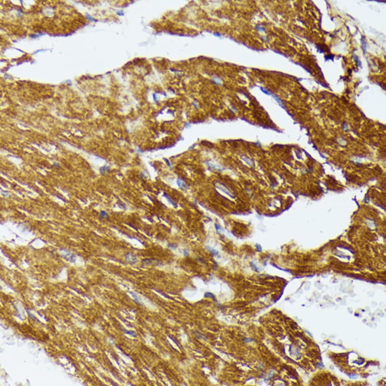 Immunohistochemistry - Anti-COX15 Antibody (A90637) - Antibodies.com