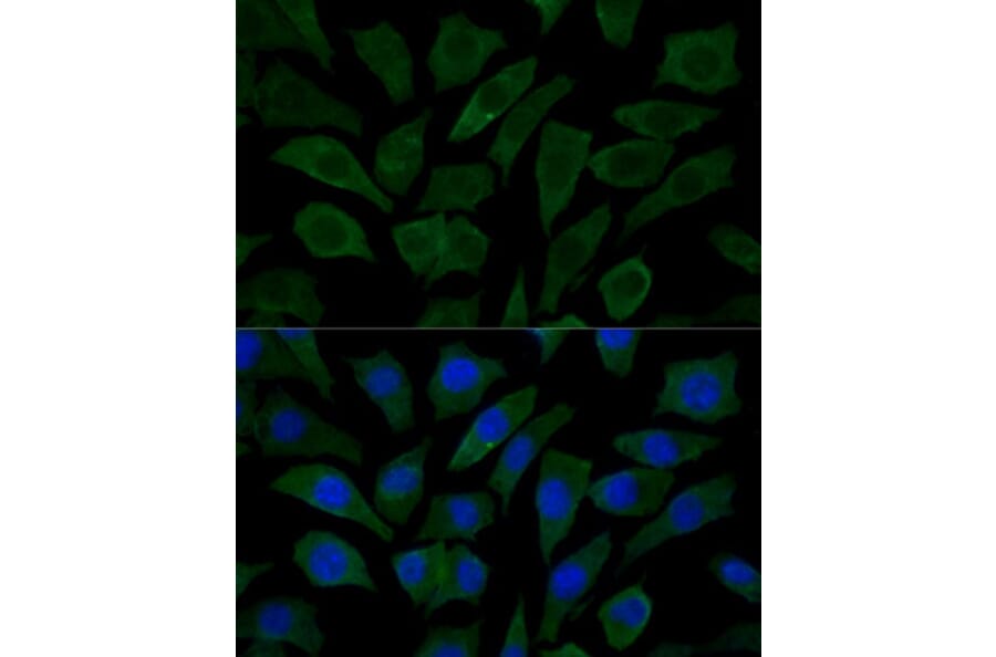 Immunofluorescence - Anti-COX15 Antibody (A90637) - Antibodies.com