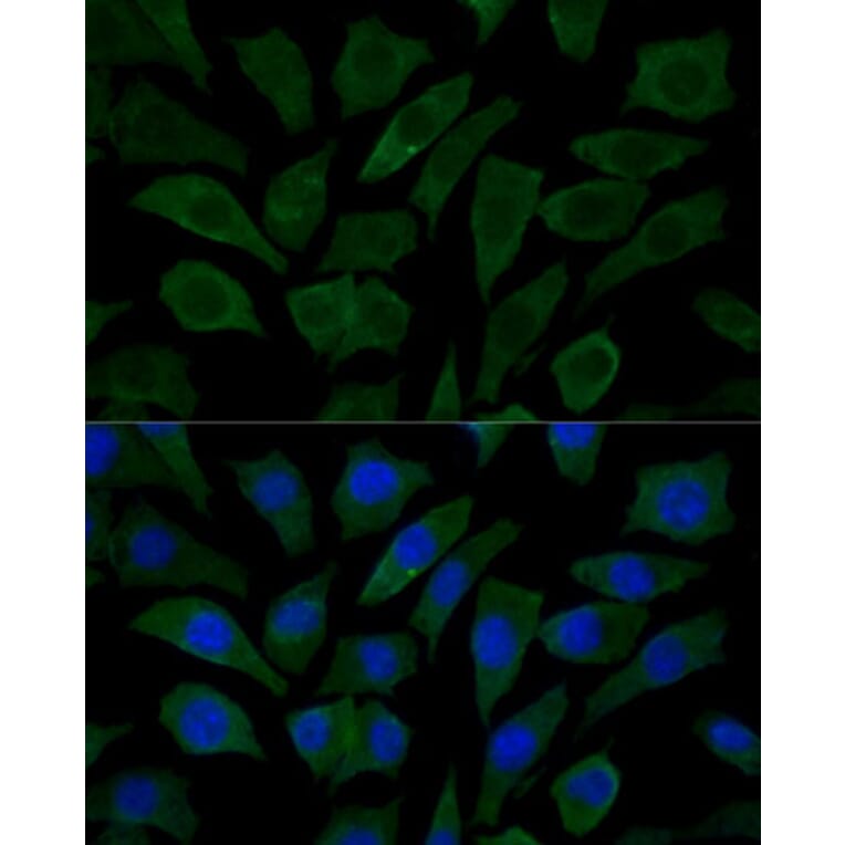 Immunofluorescence - Anti-COX15 Antibody (A90637) - Antibodies.com