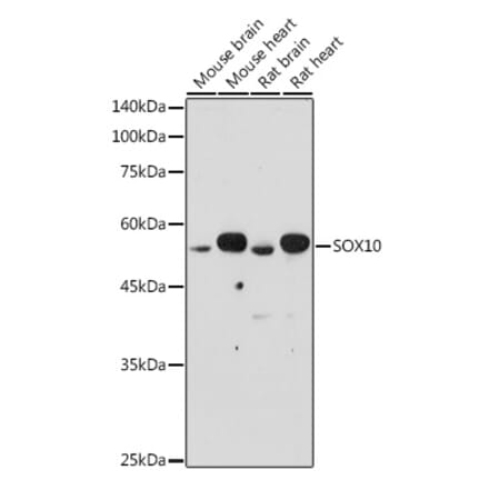 Western Blot - Anti-SOX10 Antibody (A90639) - Antibodies.com