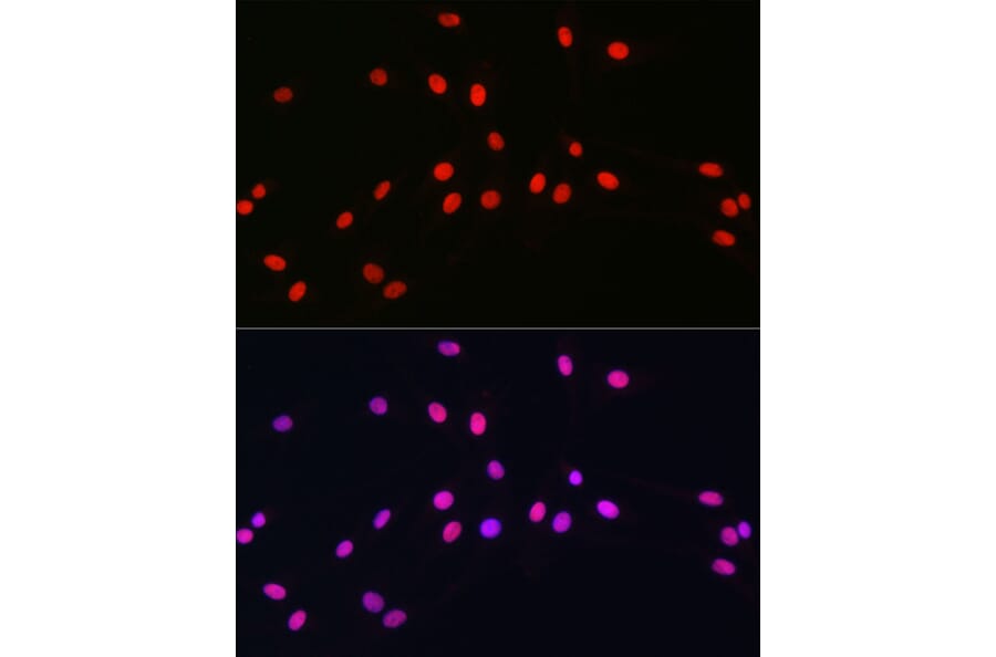 anti-SOX10 polyclonal antibody (A90639)