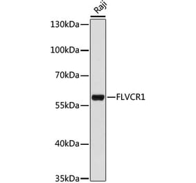 Western Blot - Anti-FLVCR1 Antibody (A90640) - Antibodies.com