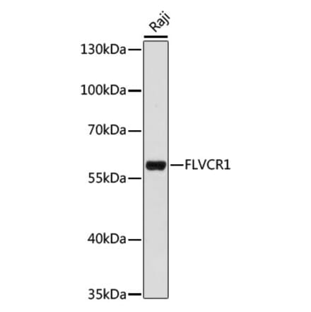 Western Blot - Anti-FLVCR1 Antibody (A90640) - Antibodies.com