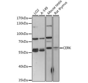 Western Blot - Anti-CERK Antibody (A90641) - Antibodies.com