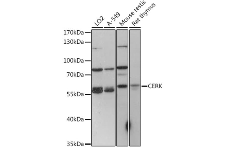 Western Blot - Anti-CERK Antibody (A90641) - Antibodies.com