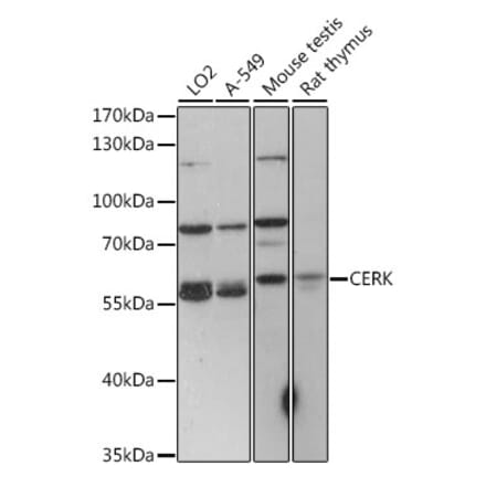 Western Blot - Anti-CERK Antibody (A90641) - Antibodies.com