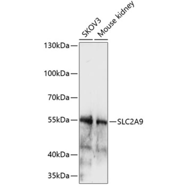 Western Blot - Anti-GLUT9 Antibody (A90642) - Antibodies.com