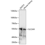 Western Blot - Anti-GLUT9 Antibody (A90642) - Antibodies.com