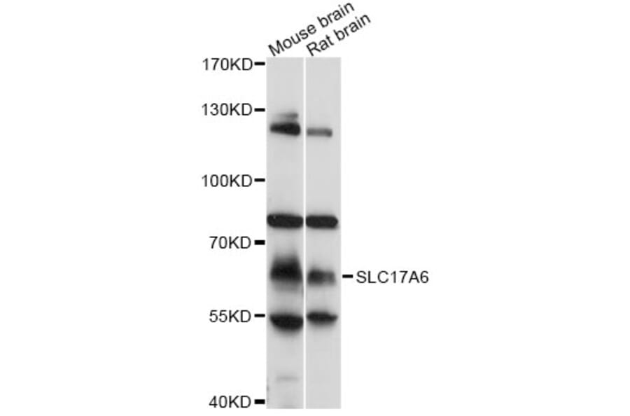 Western Blot - Anti-SLC17A6 Antibody (A13648) - Antibodies.com