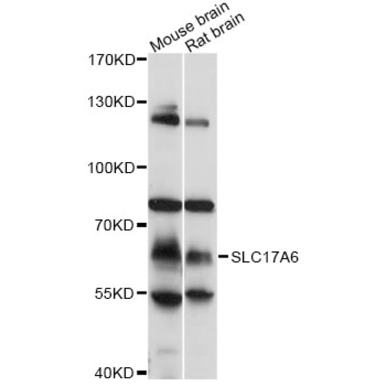 Western Blot - Anti-SLC17A6 Antibody (A13648) - Antibodies.com