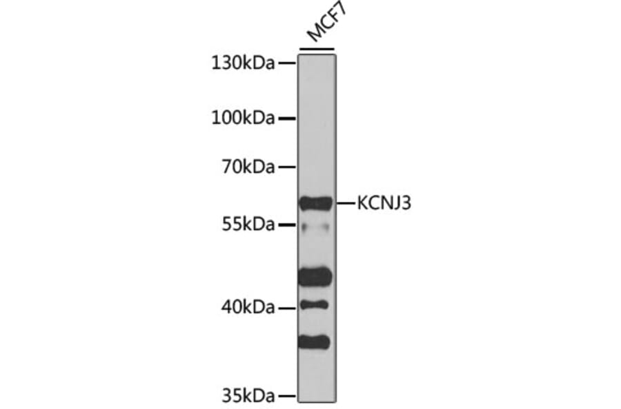 Western Blot - Anti-KCNJ3 Antibody (A12455) - Antibodies.com