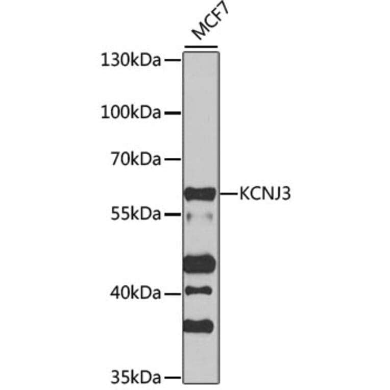 Western Blot - Anti-KCNJ3 Antibody (A12455) - Antibodies.com