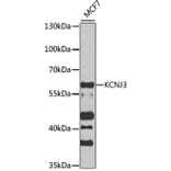 Western Blot - Anti-KCNJ3 Antibody (A12455) - Antibodies.com