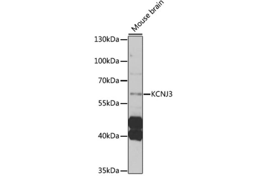 Western Blot - Anti-KCNJ3 Antibody (A12455) - Antibodies.com