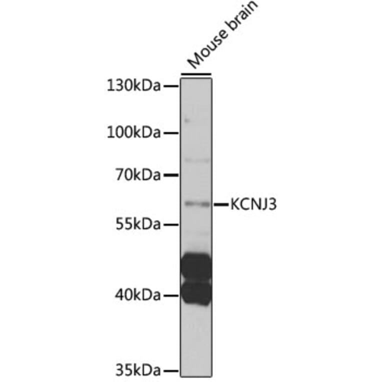 Western Blot - Anti-KCNJ3 Antibody (A12455) - Antibodies.com