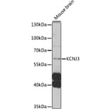 Western Blot - Anti-KCNJ3 Antibody (A12455) - Antibodies.com