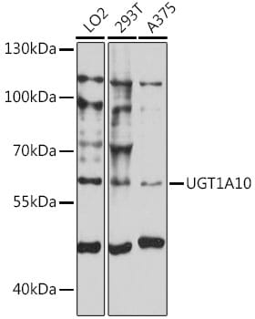 Western blot analysis of extracts of various cell lines, using µgT1A10 antibody (A16537) at 1:1,000 dilution.
Secondary antibody: Goat Anti-Rabbit IgG (H+L) (HRP) (AS014) at 1:10,000 dilution.
Lysates / proteins: 25µg per lane.
Blocking buffer: 3% non-fat dry milk in TBST.
Detection: ECL Basic Kit (RM00020).
Exposure time: 10s.