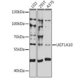 Western Blot - Anti-UGT1A10 Antibody (A90645) - Antibodies.com
